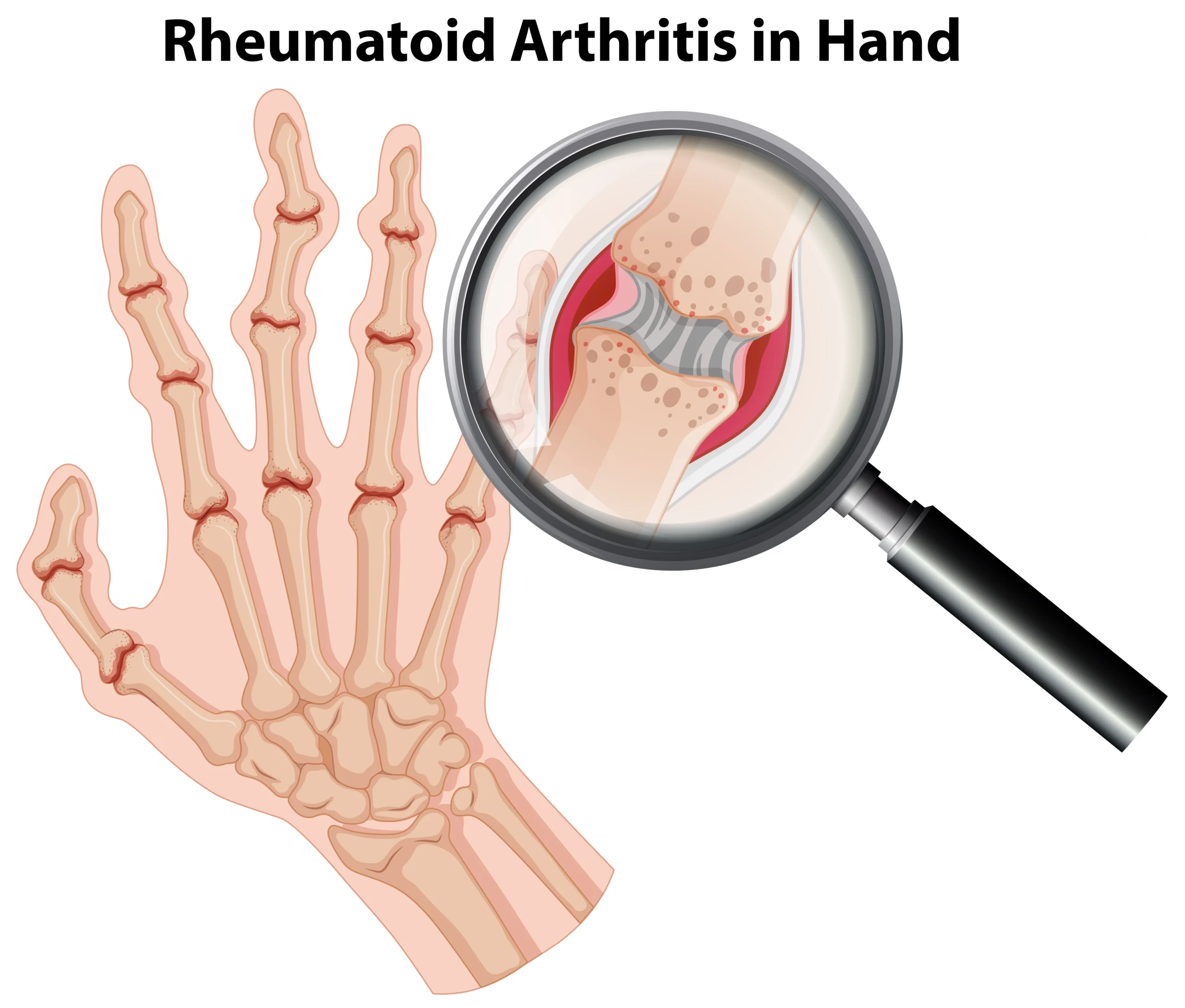 Rheumatology