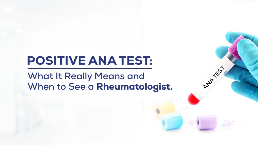 Positive ANA Test: What It Really Means and When to See a Rheumatologist