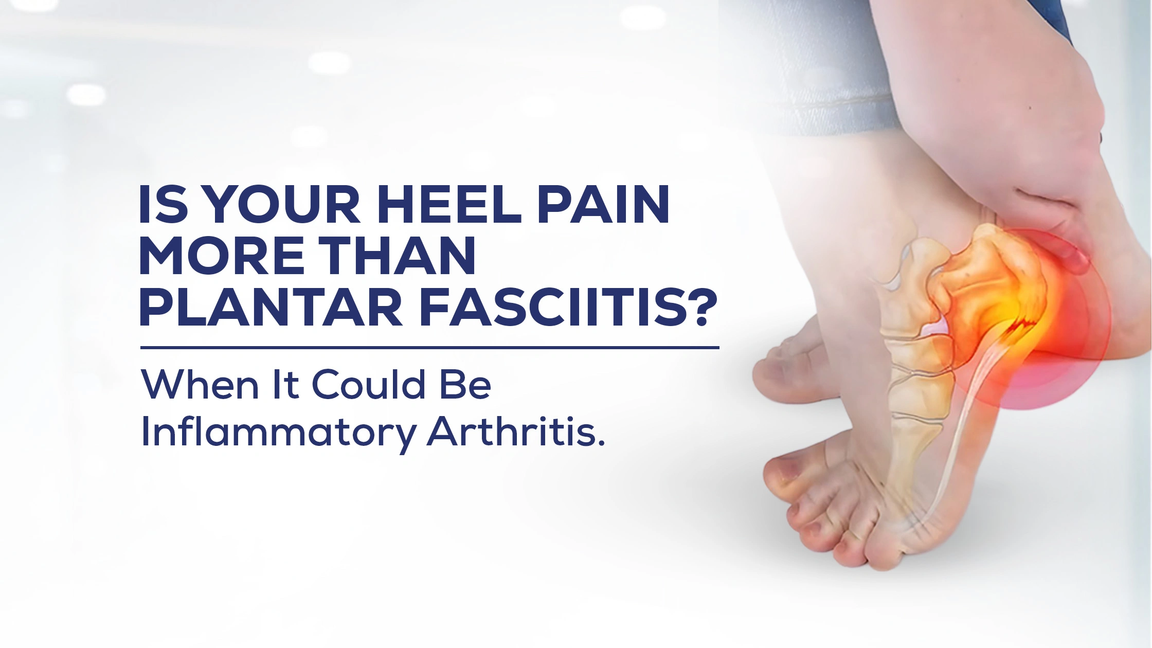 Is Your Heel Pain or Plantar Fasciitis that simple? It Could Be Psoriatic Arthritis