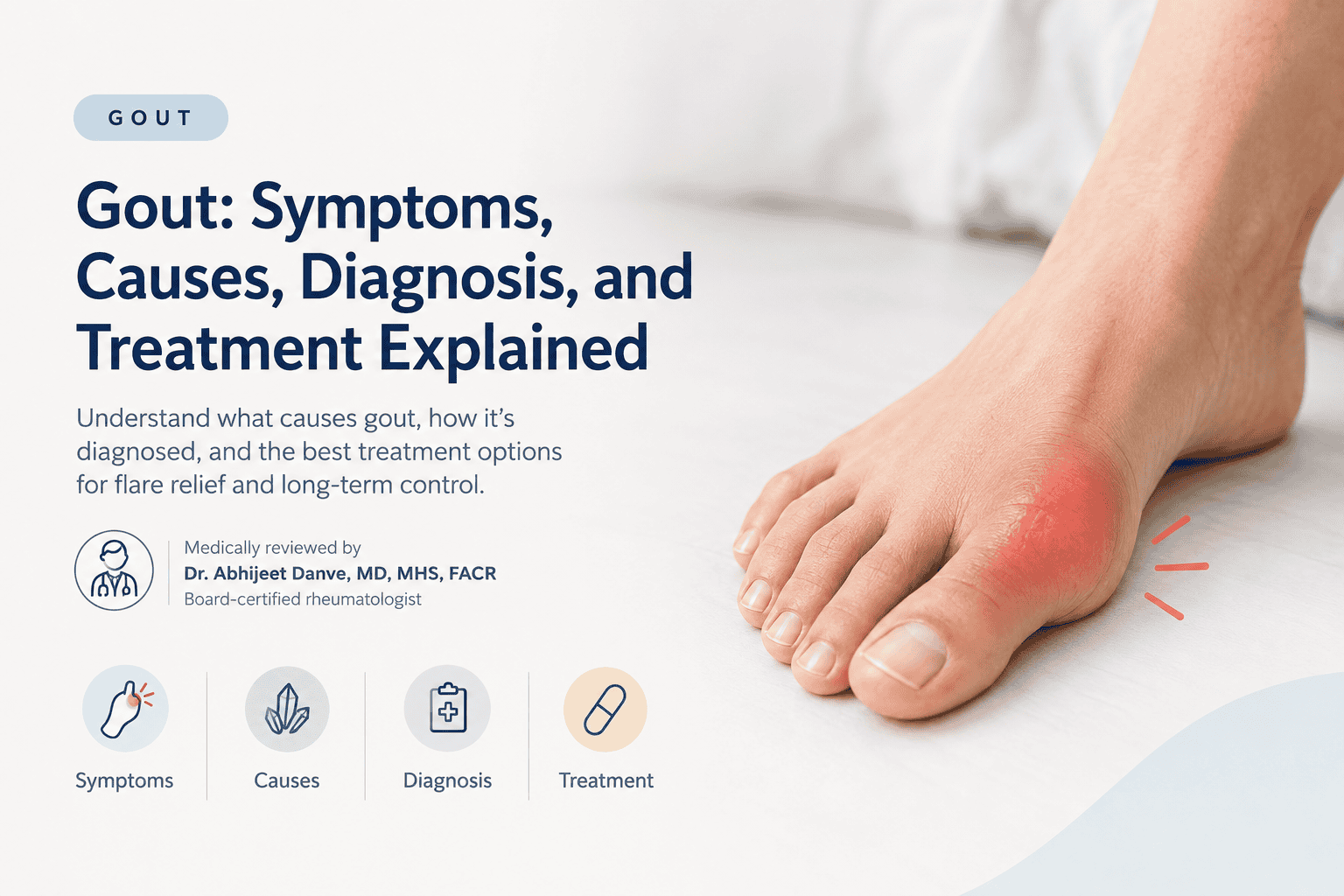 gout blog image